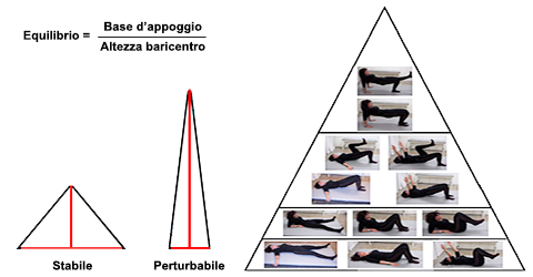 sclerosi multipla